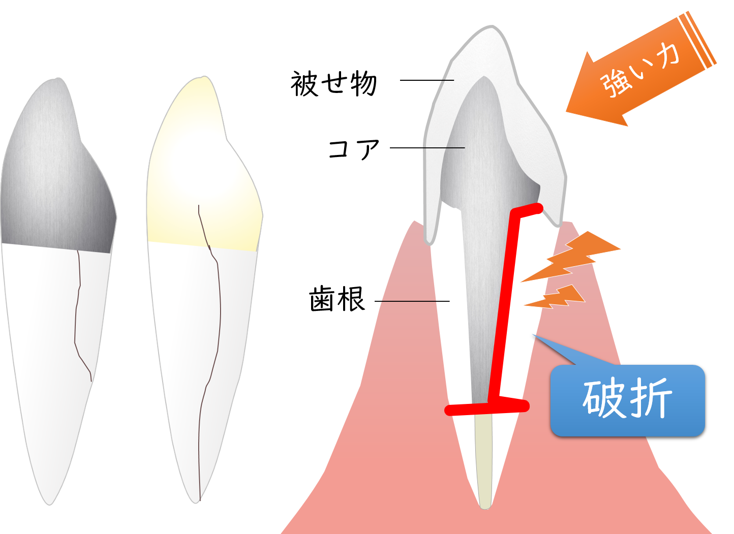 新浦安（浦安市）の歯医者で歯科用ＣＴ